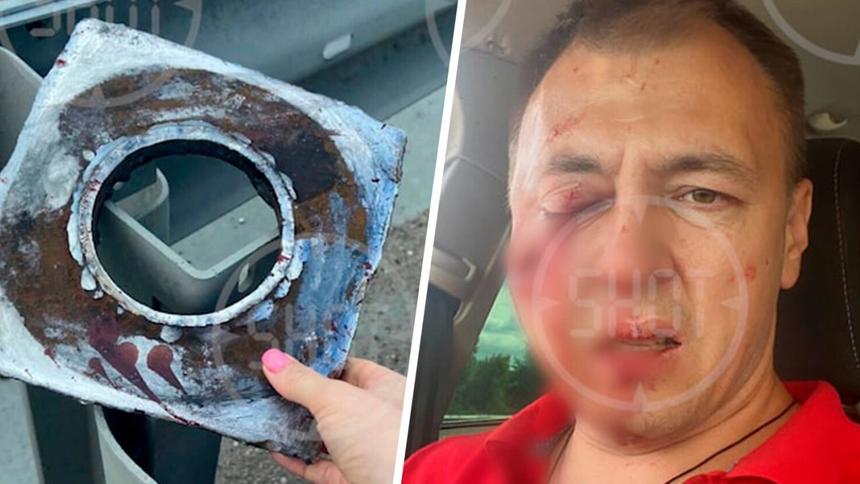Дорожников будут судить за покалечившую водителя пластину